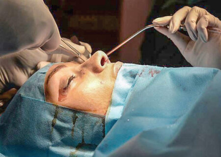 افزایش آمار جراحی‌های زیبایی بینی همزمان با شیوع کرونا/ میانگین هزینه جراحی رینوپلاستی